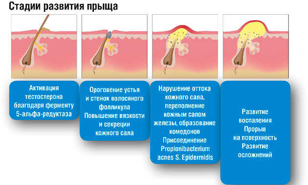 стадии развития угрей
